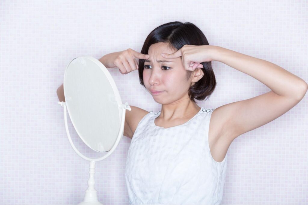 おでこ しわ 40代