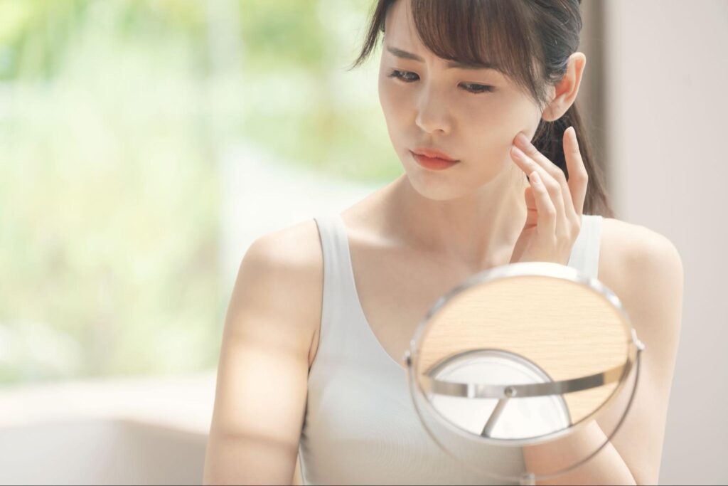 たるみ 30代