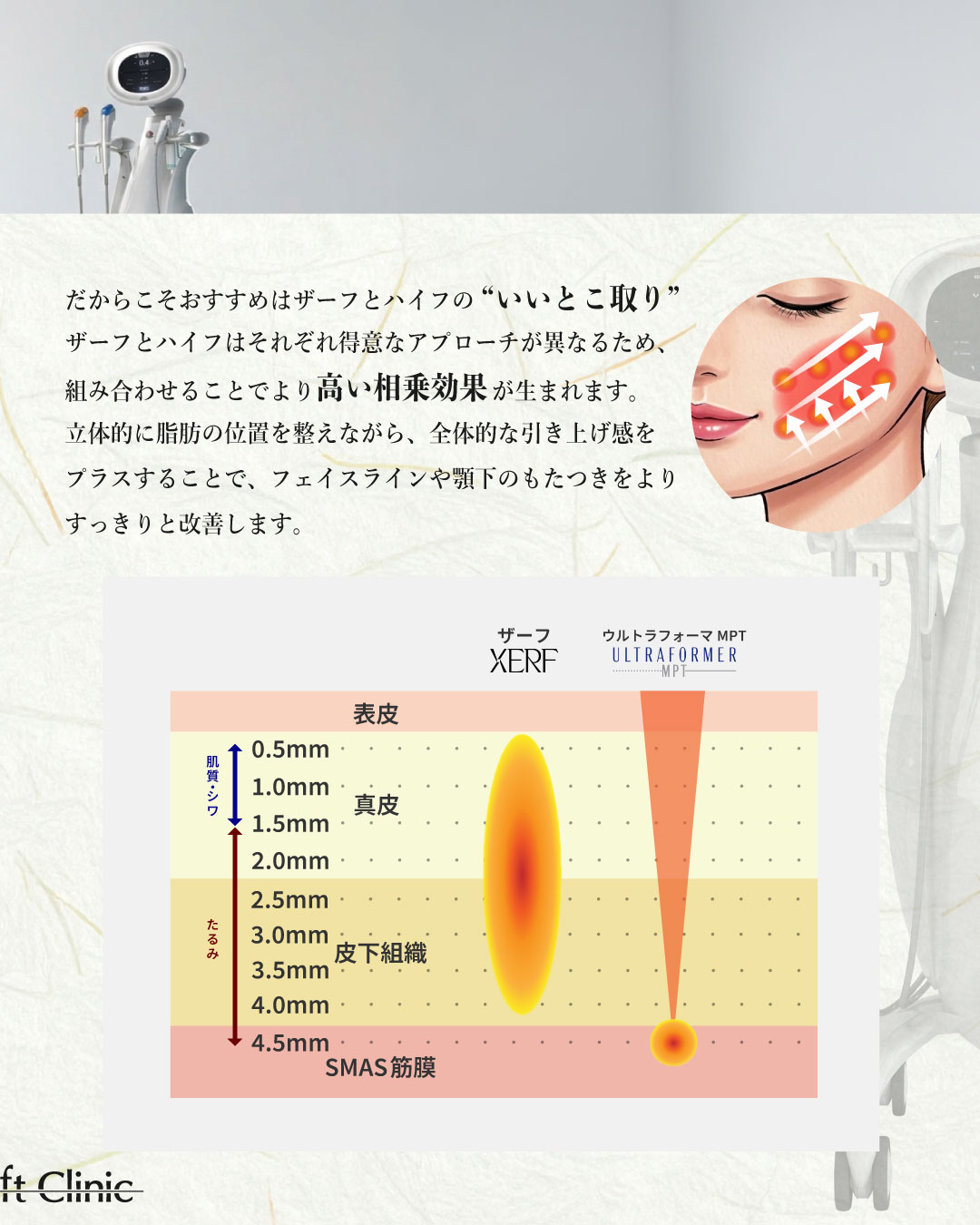 ザイフ8